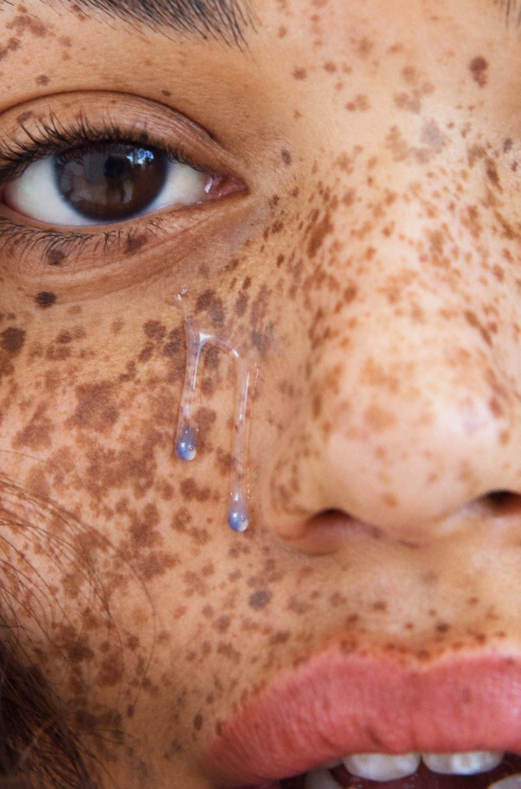 Close-up of naturally freckled skin with a translucent blue serum drip
