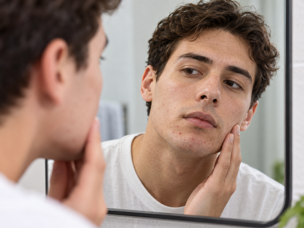 Copper Peptides for Acne-Prone and Oily Skin: What GHK-Cu Can (and Can't) Do for Breakouts