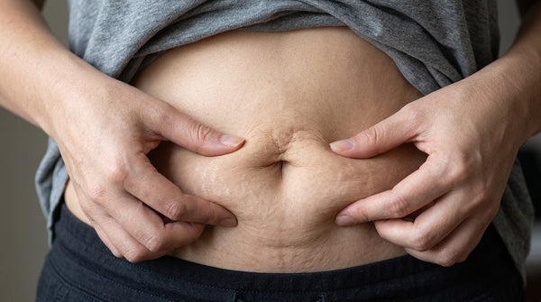 Skin Laxity After Weight Loss: What Copper Peptides Can and Can't Do