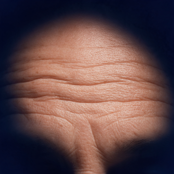 Close-up of horizontal forehead lines