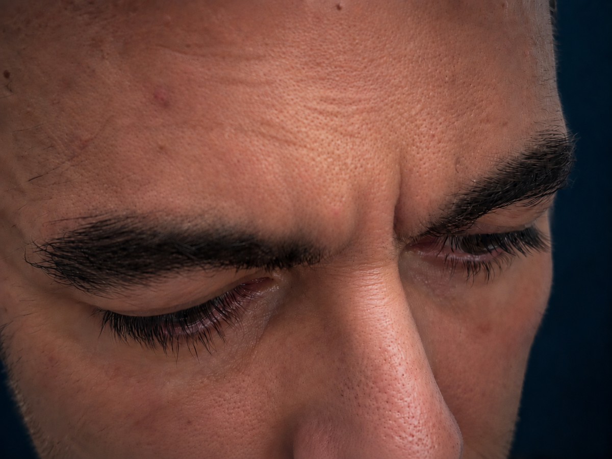 Forehead